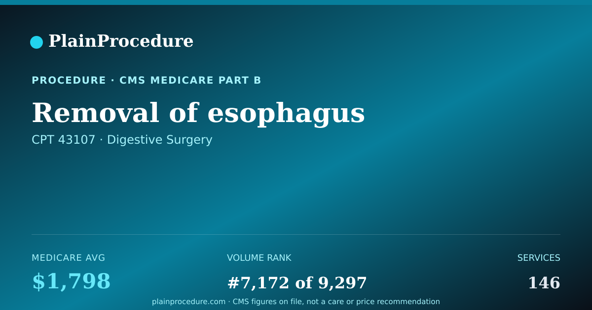 Shareable card for Removal Of Esophagus