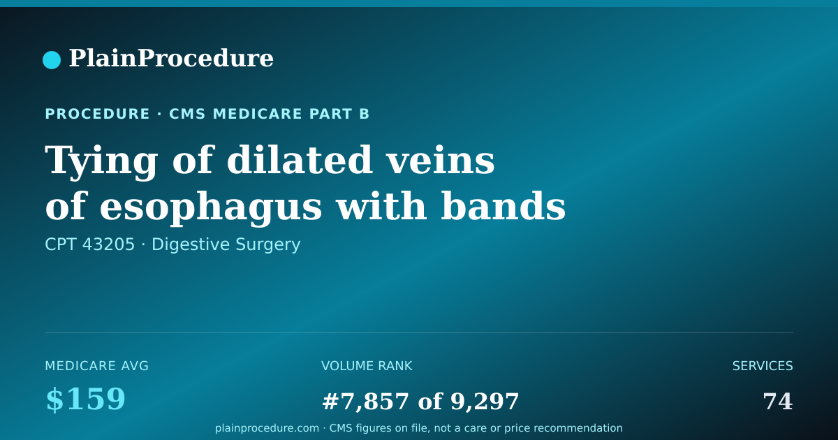 Shareable card for Tying Of Dilated Veins Of Esophagus With Bands Using A Flexible Endoscope