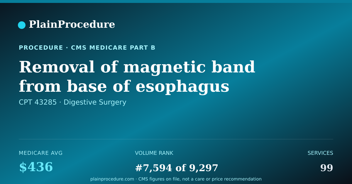 Shareable card for Removal Of Magnetic Band From Base Of Esophagus Using An Endoscope