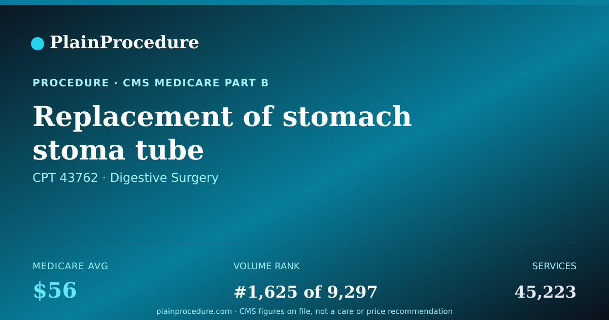 Shareable card for Replacement Of Stomach Stoma Tube