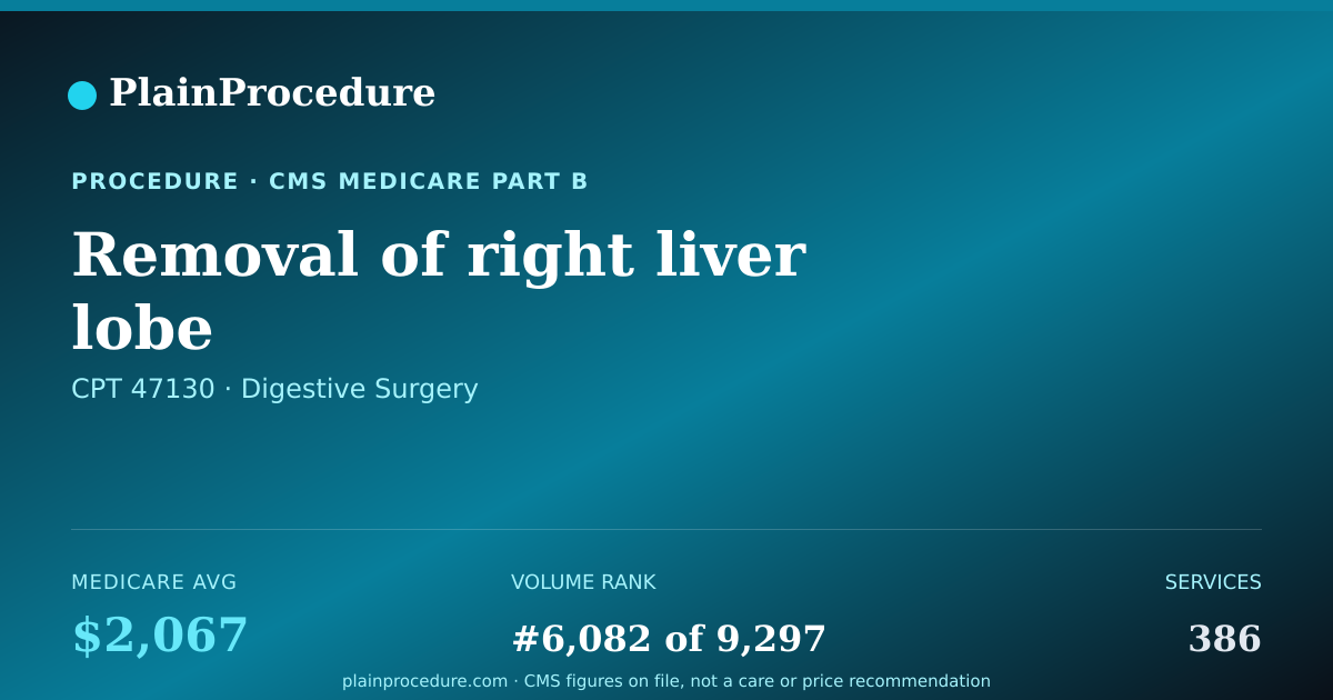 Shareable card for Removal Of Right Liver Lobe