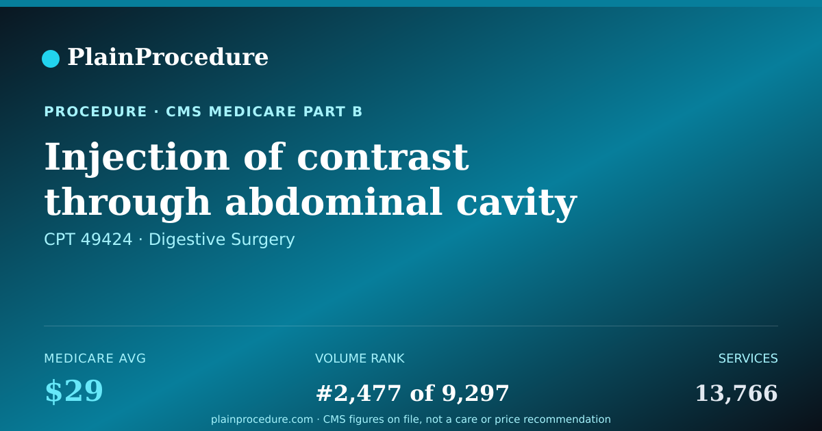 Shareable card for Injection Of Contrast Through Abdominal Cavity Tube For X-Ray Study