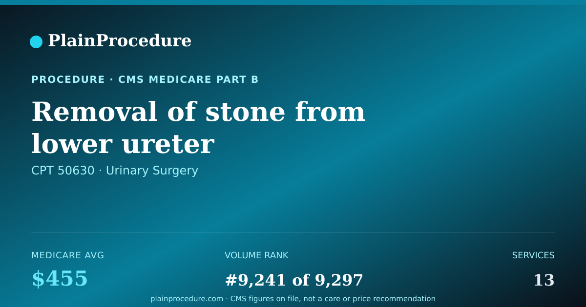 Shareable card for Removal Of Stone From Lower Ureter