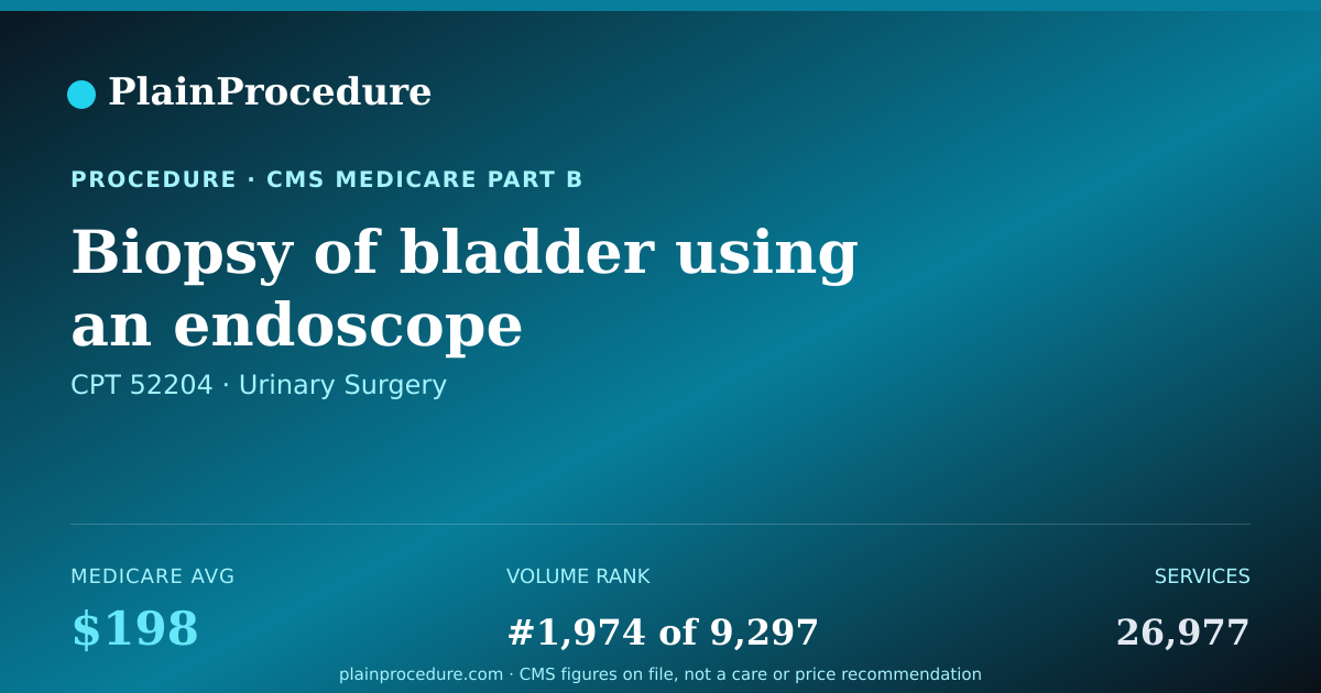 Shareable card for Biopsy Of Bladder Using An Endoscope