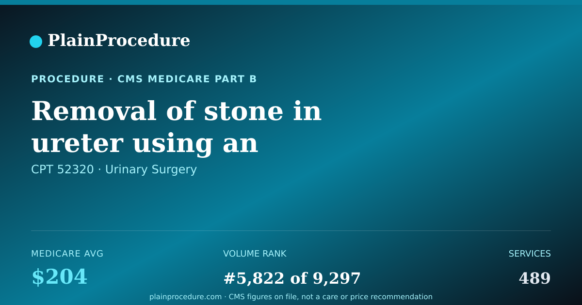 Shareable card for Removal Of Stone In Ureter Using An Endoscope