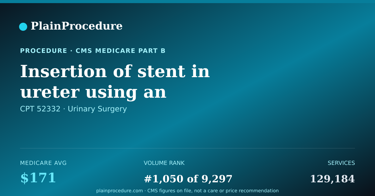 Shareable card for Insertion Of Stent In Ureter Using An Endoscope