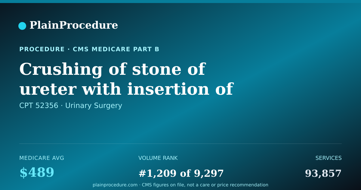 Shareable card for Crushing Of Stone Of Ureter With Insertion Of Stent Using An Endoscope