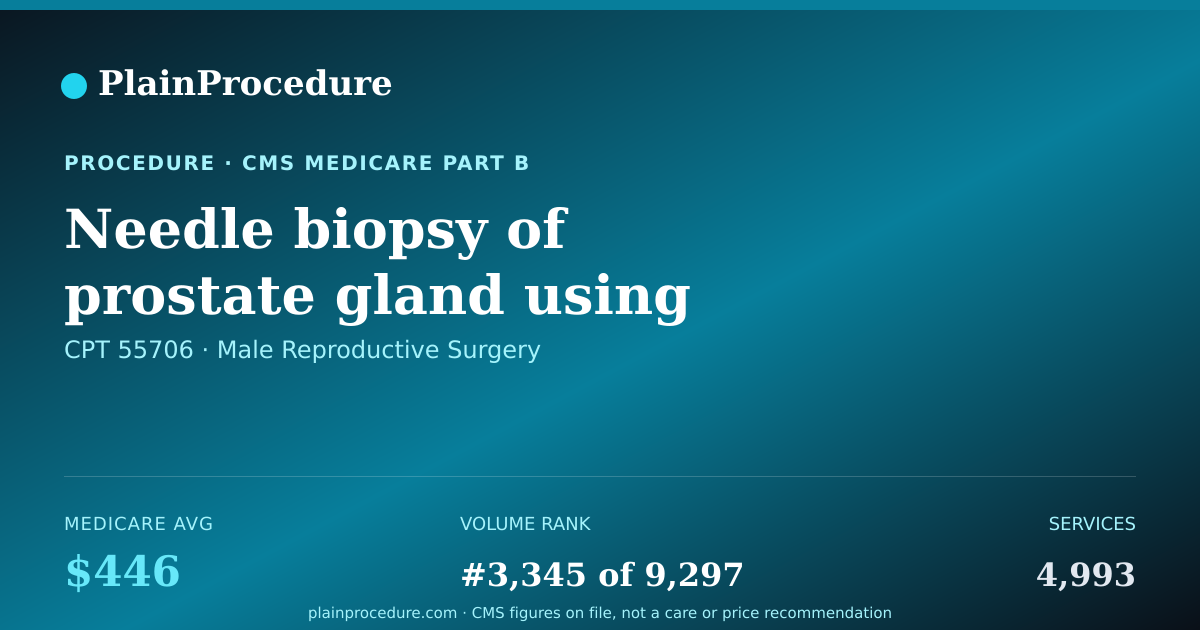 Shareable card for Needle Biopsy Of Prostate Gland Using Image Guidance