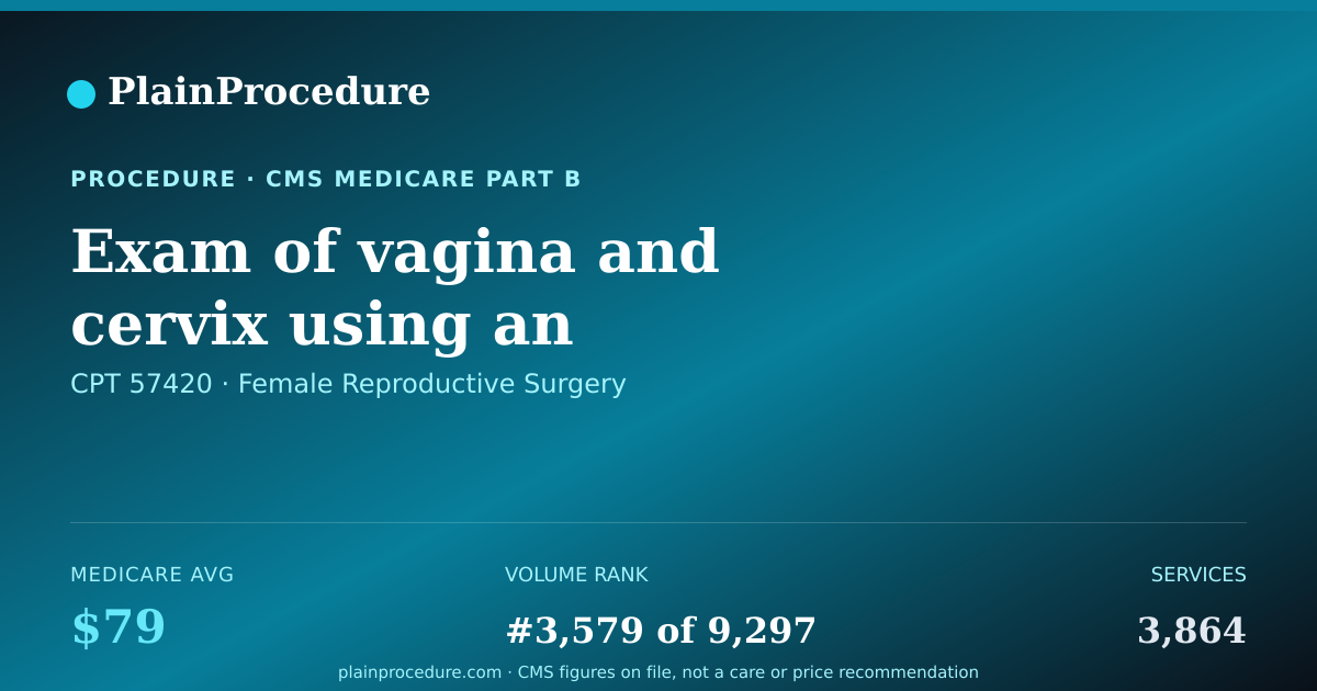 Shareable card for Exam Of Vagina And Cervix Using An Endoscope