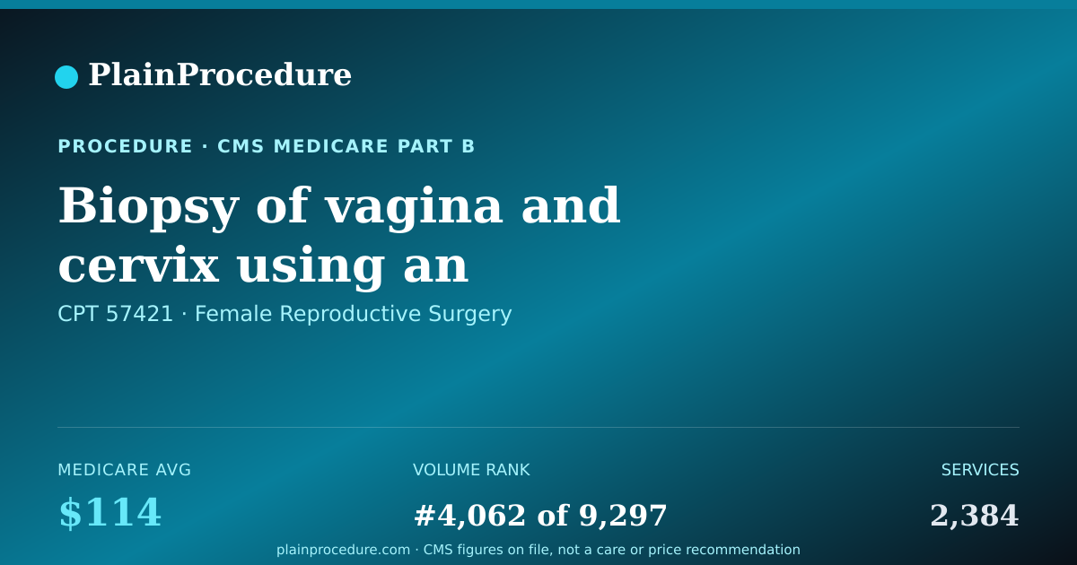 Shareable card for Biopsy Of Vagina And Cervix Using An Endoscope