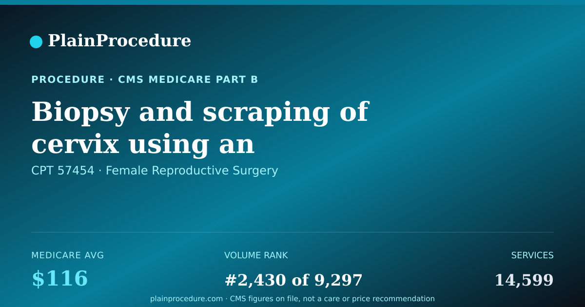 Shareable card for Biopsy And Scraping Of Cervix Using An Endoscope