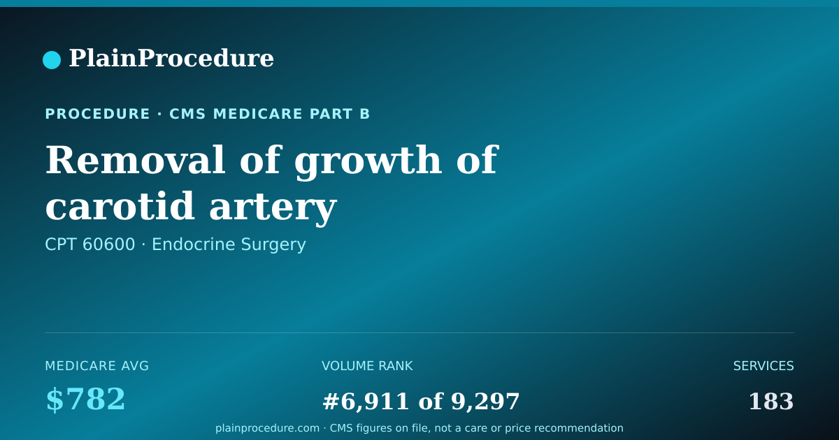 Shareable card for Removal Of Growth Of Carotid Artery