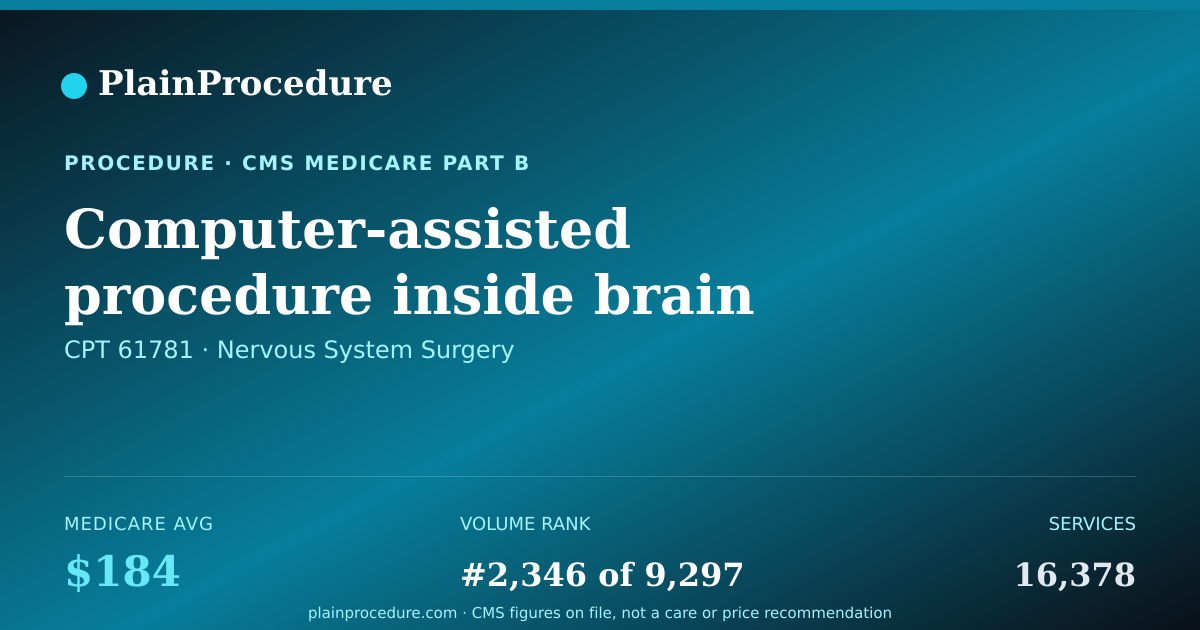 Shareable card for Computer-Assisted Procedure Inside Brain