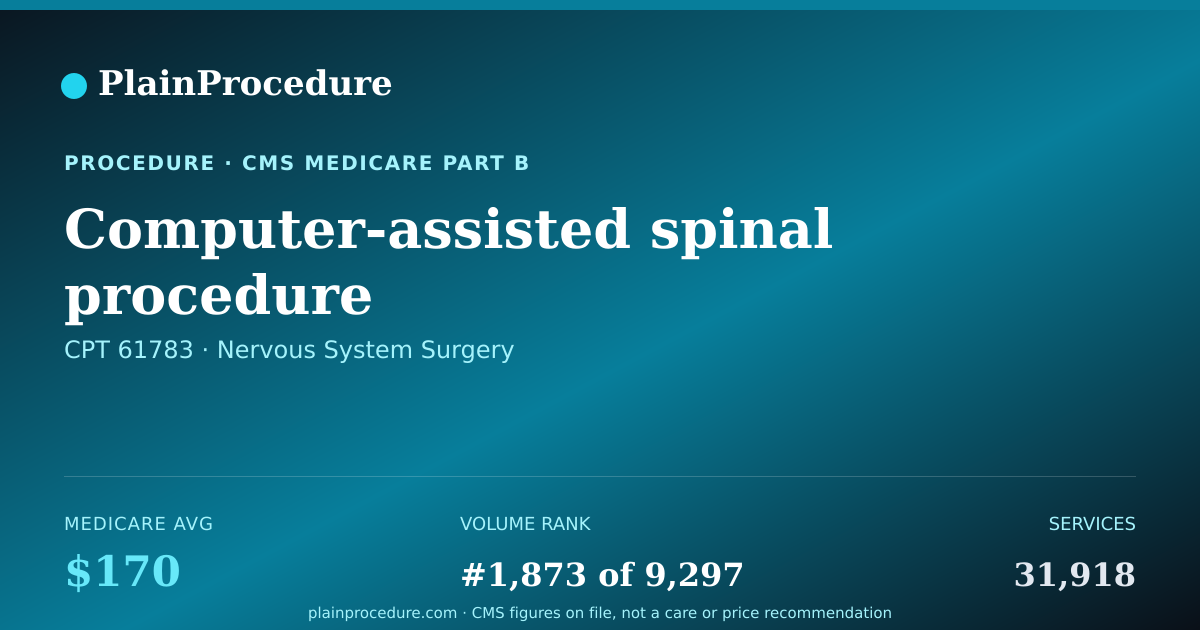 Shareable card for Computer-Assisted Spinal Procedure