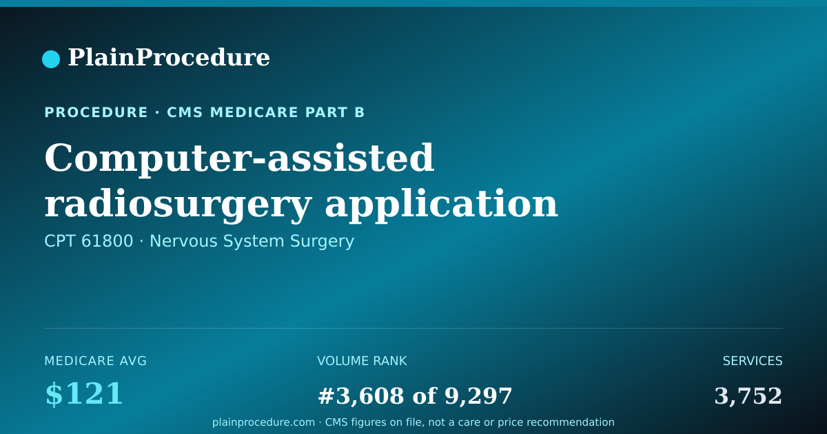 Shareable card for Computer-Assisted Radiosurgery Application Of Headframe
