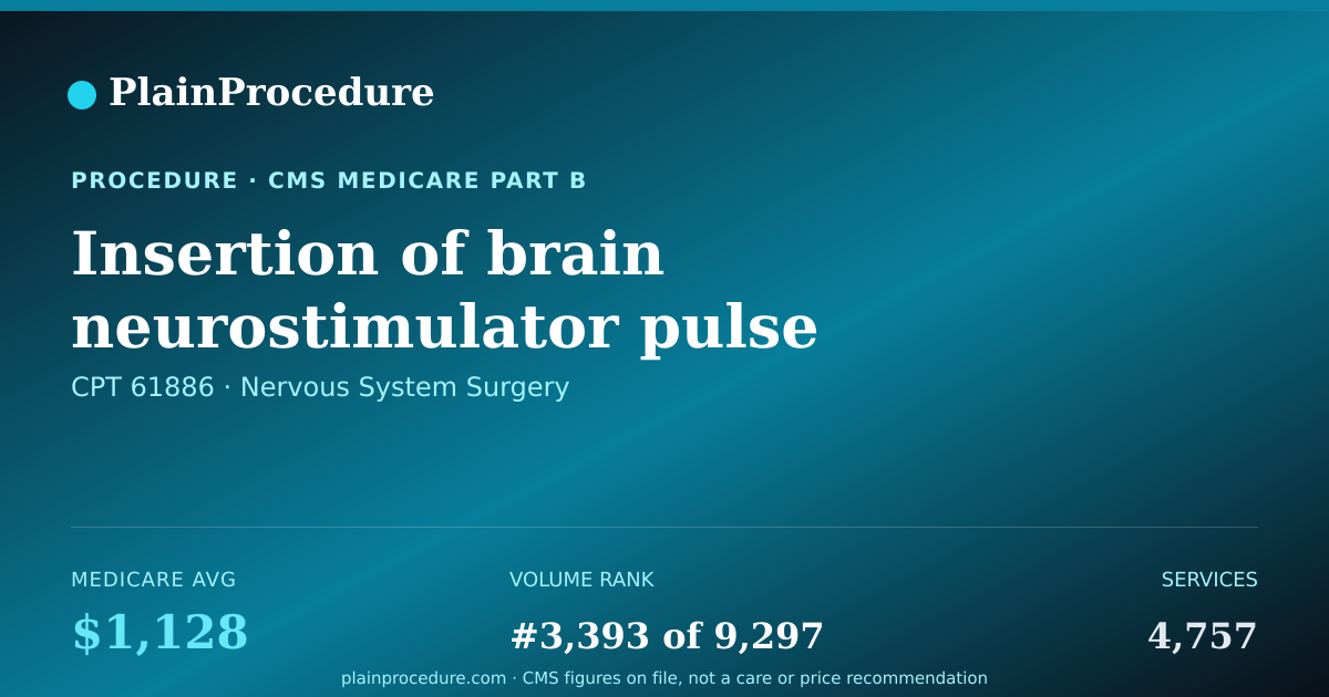 Shareable card for Insertion Of Brain Neurostimulator Pulse Device With Connection To 2 Or More Electrode Arrays