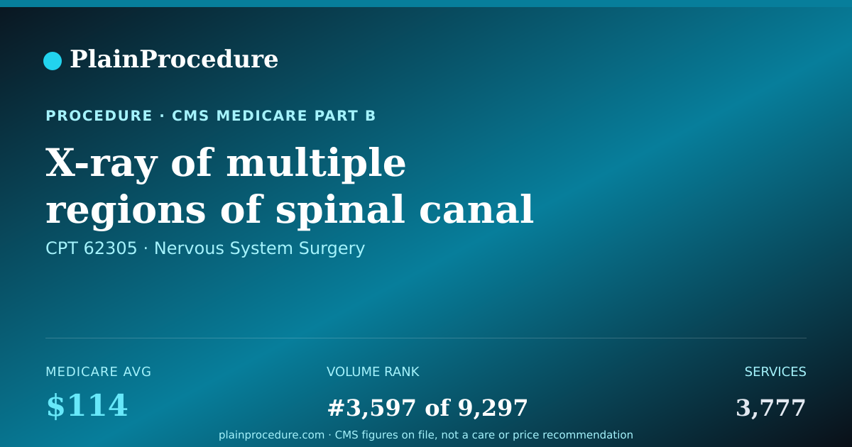 Shareable card for X-Ray Of Multiple Regions Of Spinal Canal With Review By Radiologist