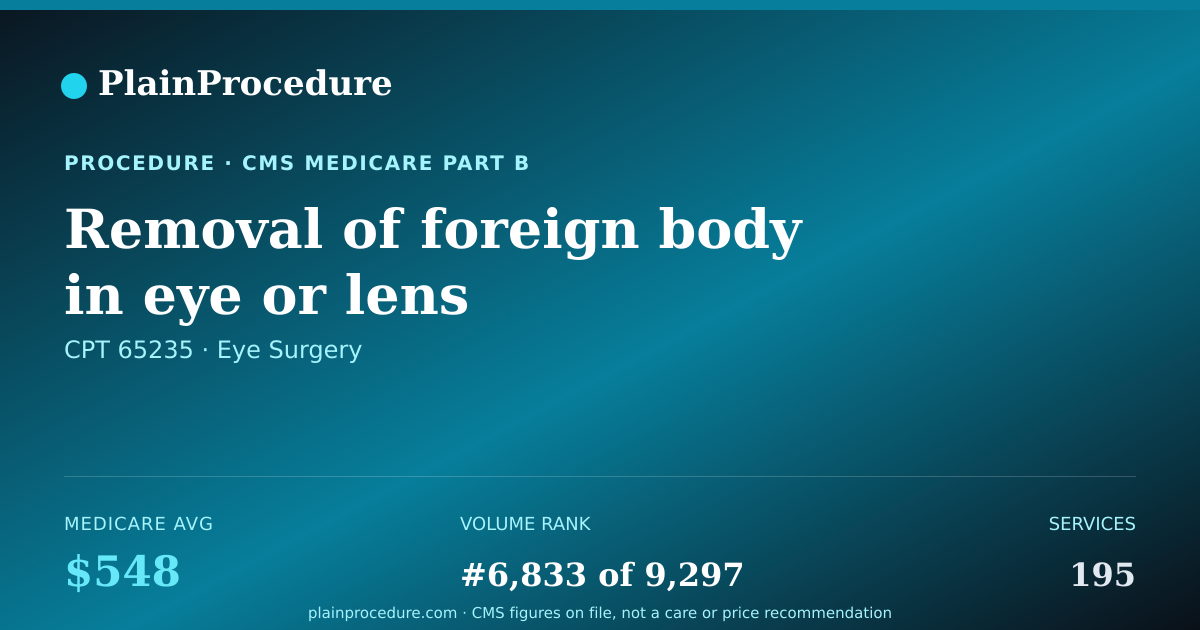 Shareable card for Removal Of Foreign Body In Eye Or Lens