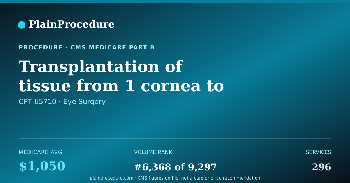 Shareable card for Transplantation Of Tissue From 1 Cornea To Other Cornea