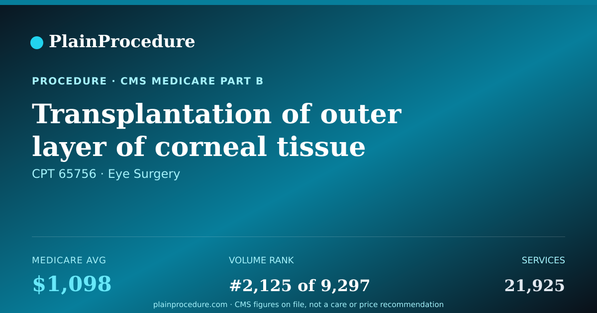 Shareable card for Transplantation Of Outer Layer Of Corneal Tissue
