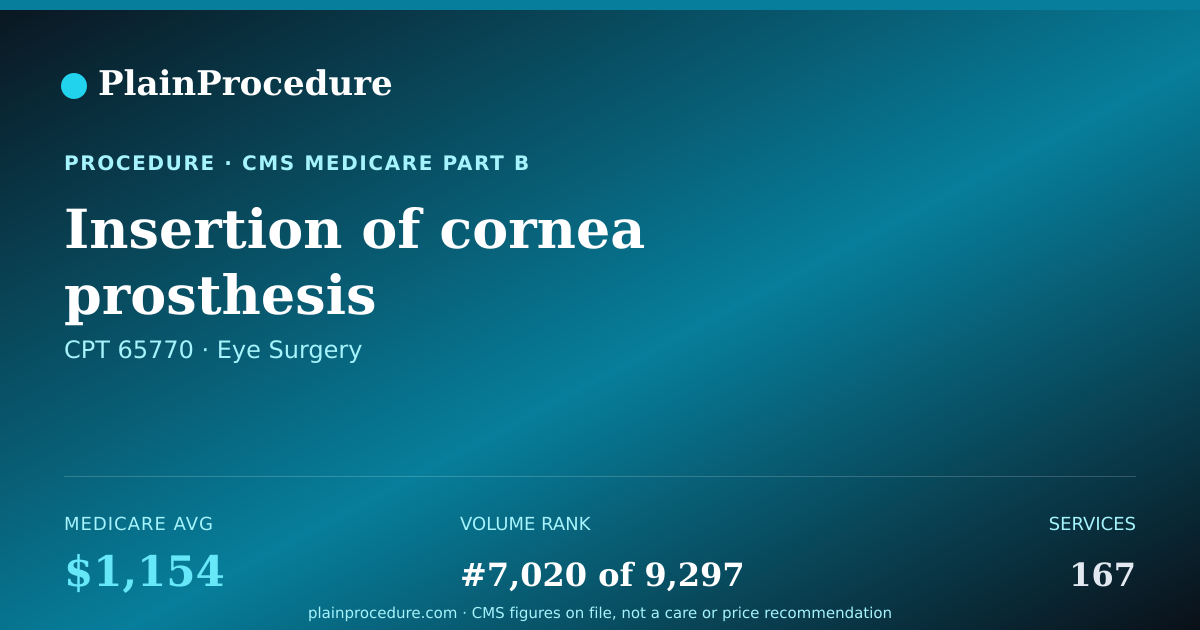 Shareable card for Insertion Of Cornea Prosthesis