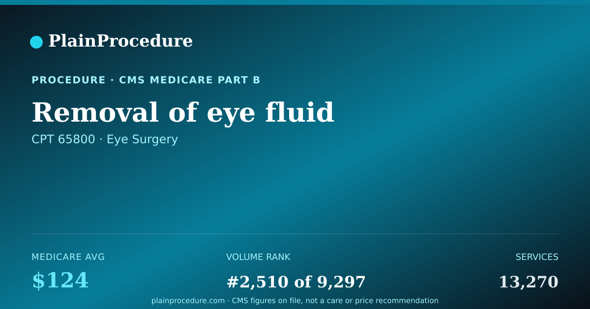 Shareable card for Removal Of Eye Fluid