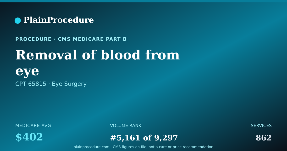 Shareable card for Removal Of Blood From Eye