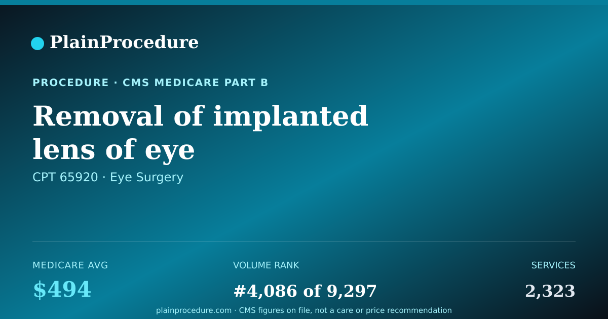 Shareable card for Removal Of Implanted Lens Of Eye