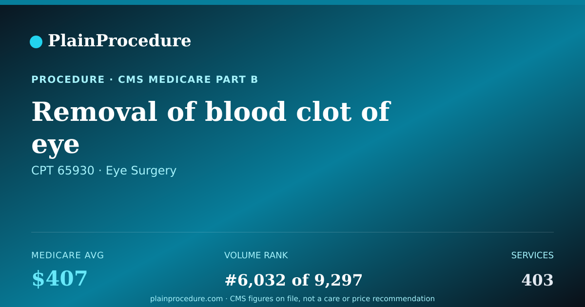 Shareable card for Removal Of Blood Clot Of Eye