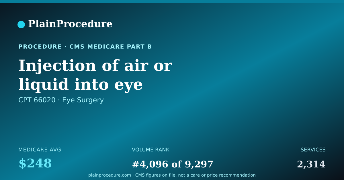 Shareable card for Injection Of Air Or Liquid Into Eye