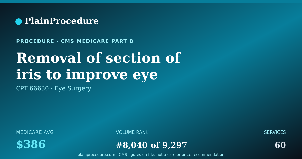 Shareable card for Removal Of Section Of Iris To Improve Eye Fluid Flow