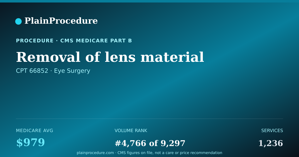 Shareable card for Removal Of Lens Material
