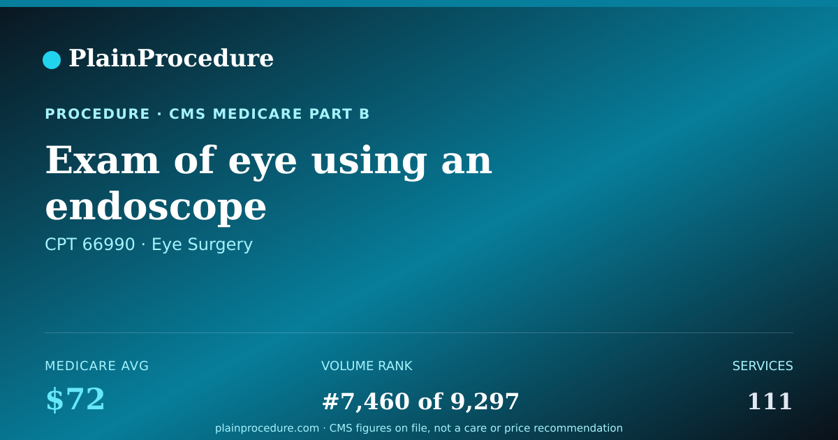 Shareable card for Exam Of Eye Using An Endoscope