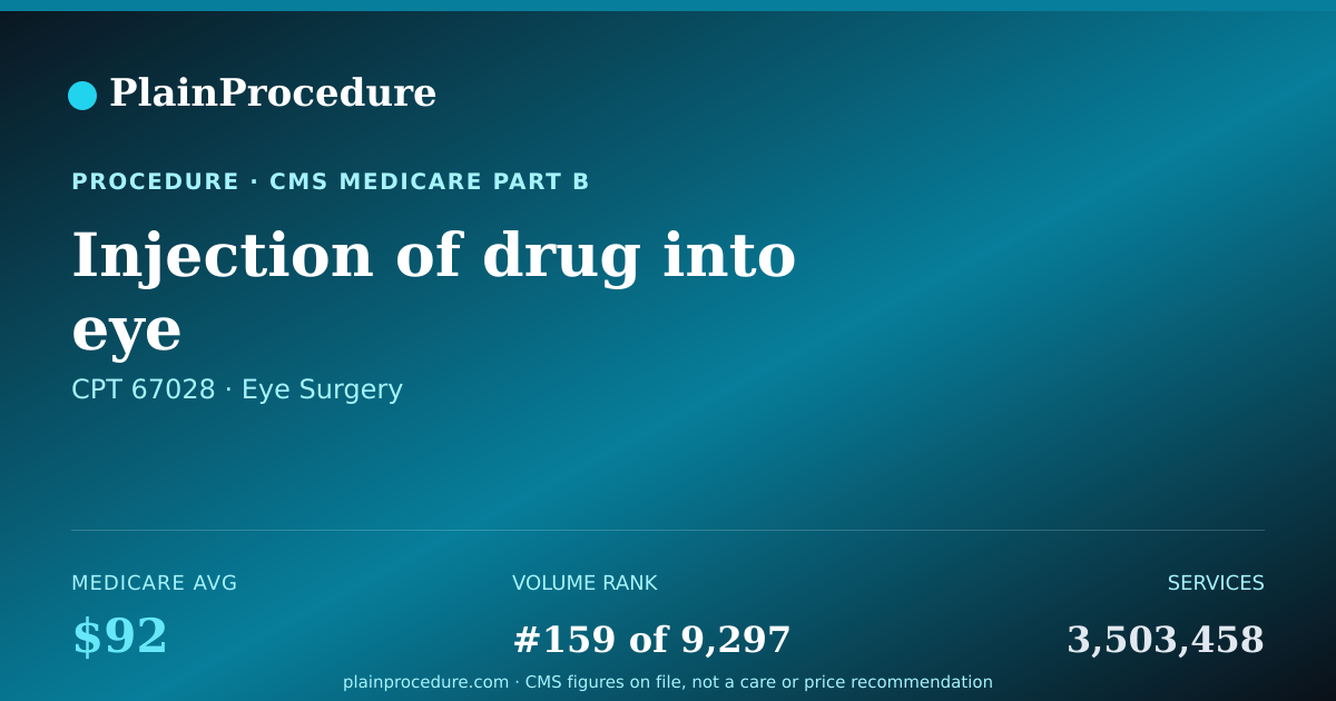 Shareable card for Injection Of Drug Into Eye