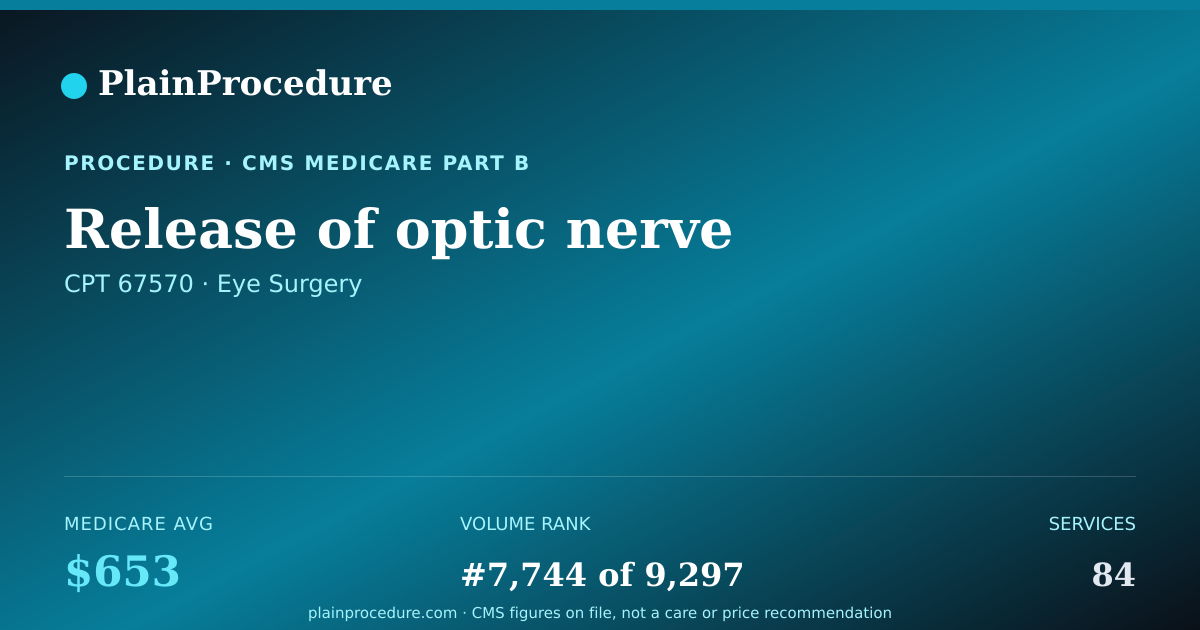Shareable card for Release Of Optic Nerve