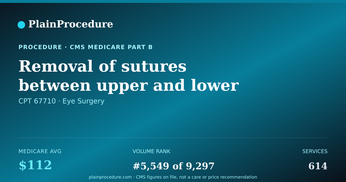 Shareable card for Removal Of Sutures Between Upper And Lower Eyelids