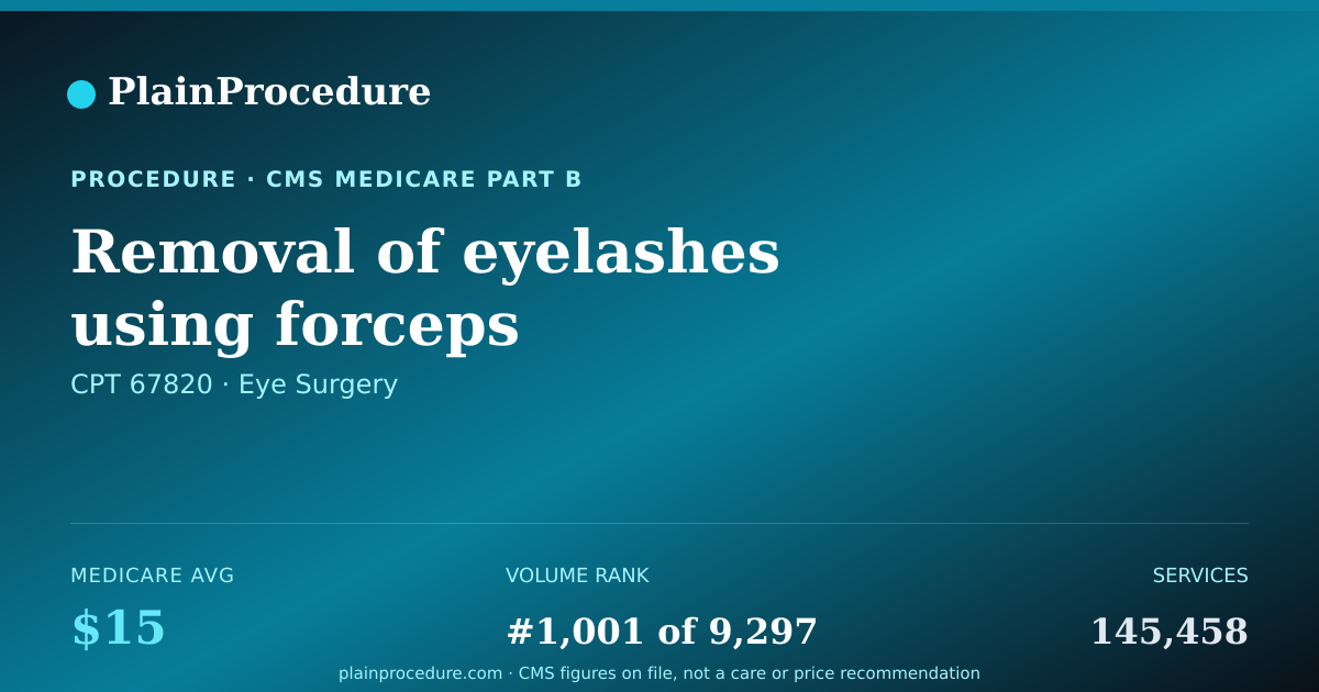 Shareable card for Removal Of Eyelashes Using Forceps