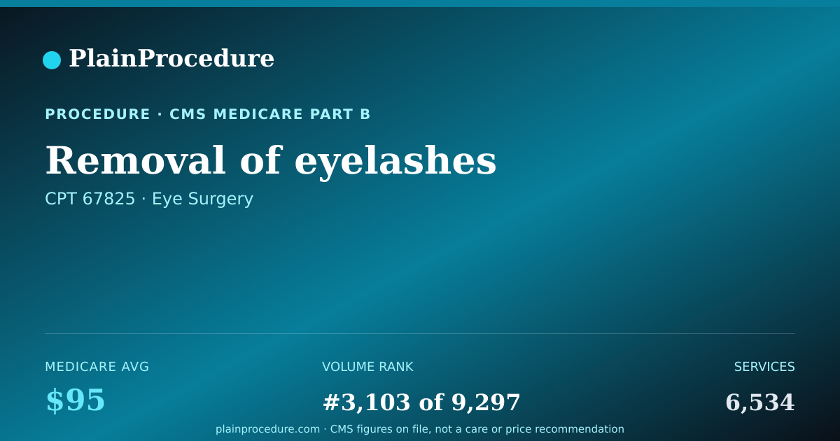Shareable card for Removal Of Eyelashes