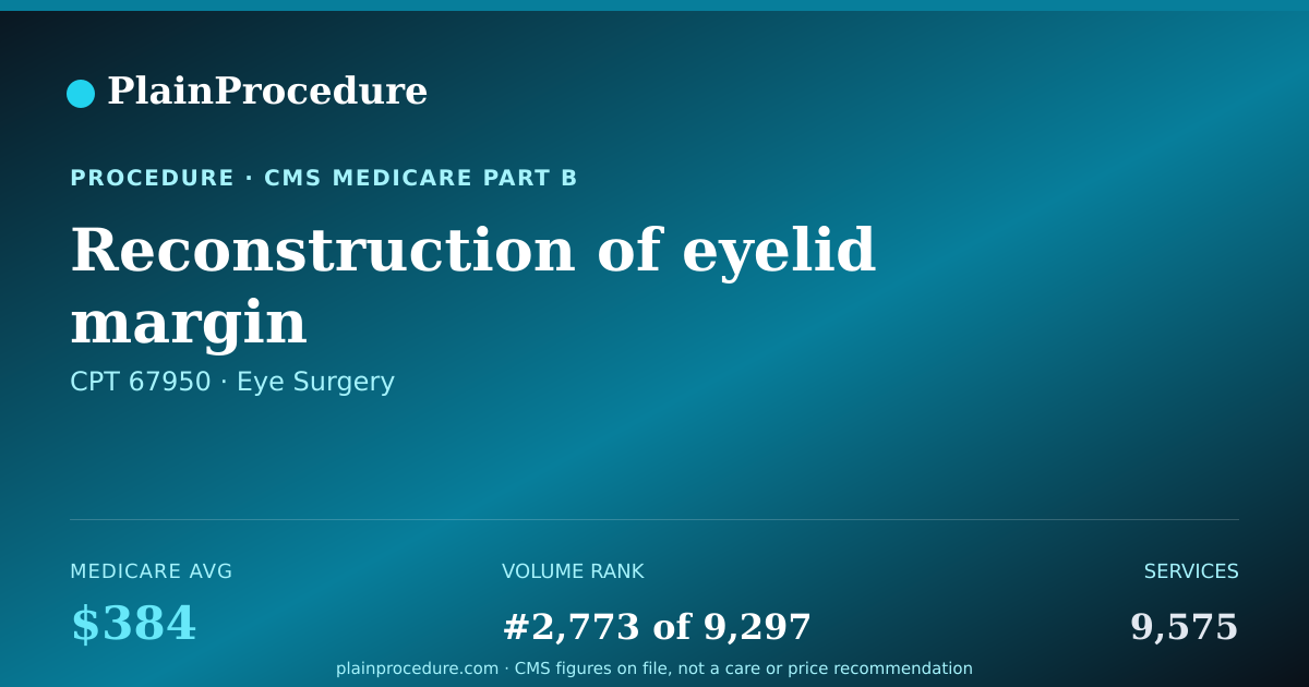 Shareable card for Reconstruction Of Eyelid Margin