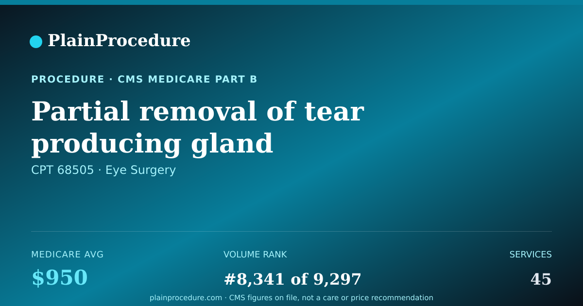 Shareable card for Partial Removal Of Tear Producing Gland