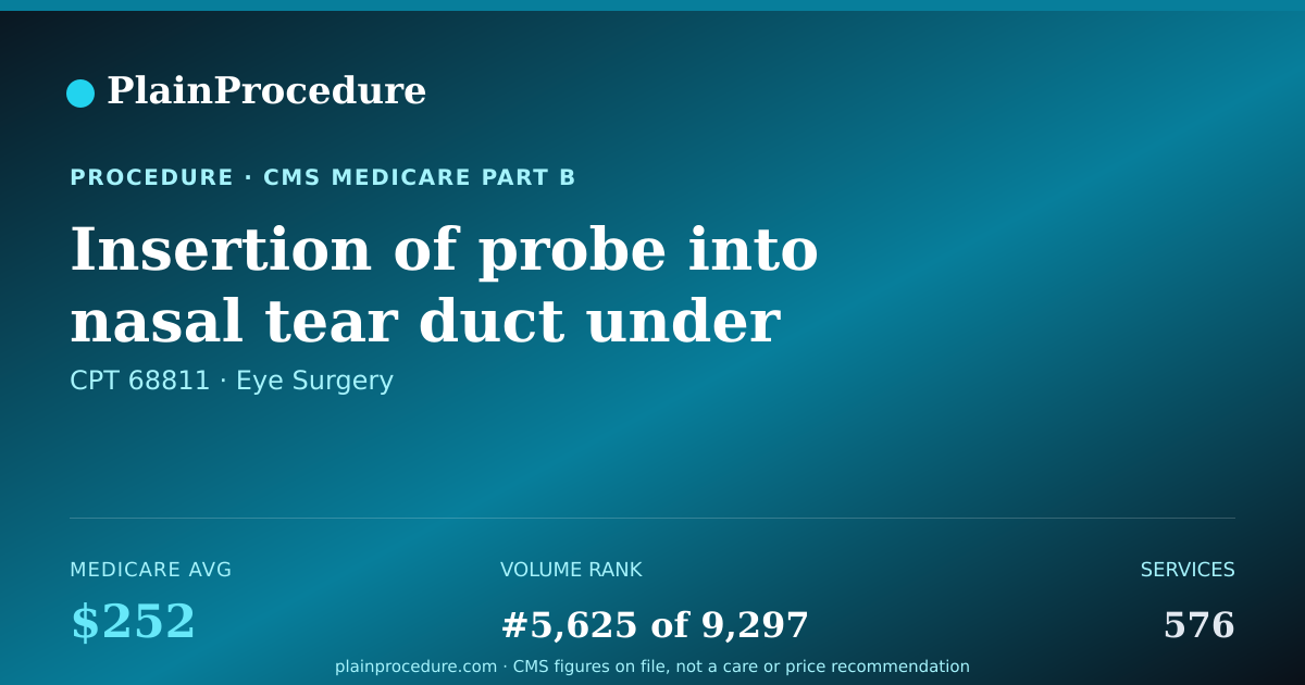 Shareable card for Insertion Of Probe Into Nasal Tear Duct Under Anesthesia