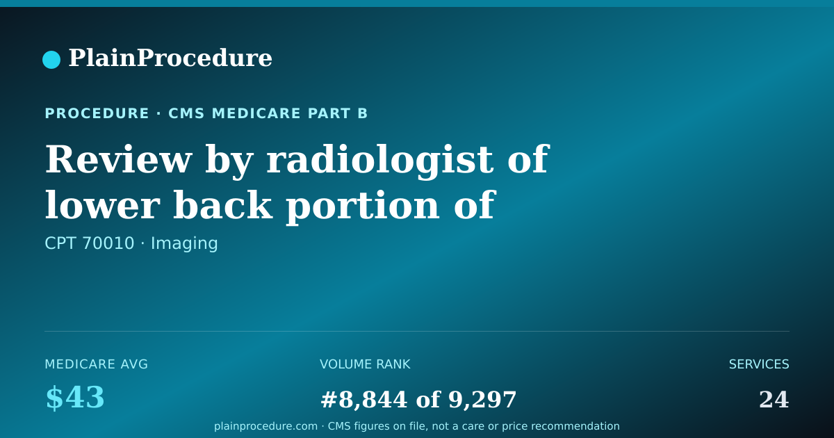 Shareable card for Review By Radiologist Of Lower Back Portion Of Brain Image