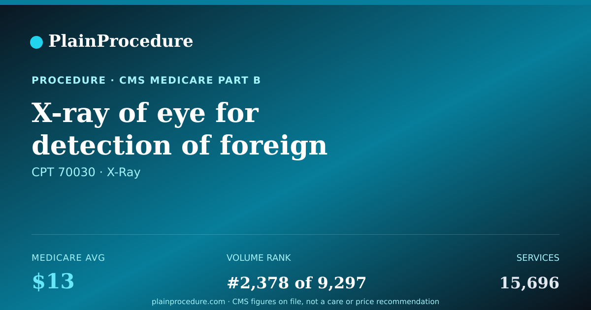 Shareable card for X-Ray Of Eye For Detection Of Foreign Body