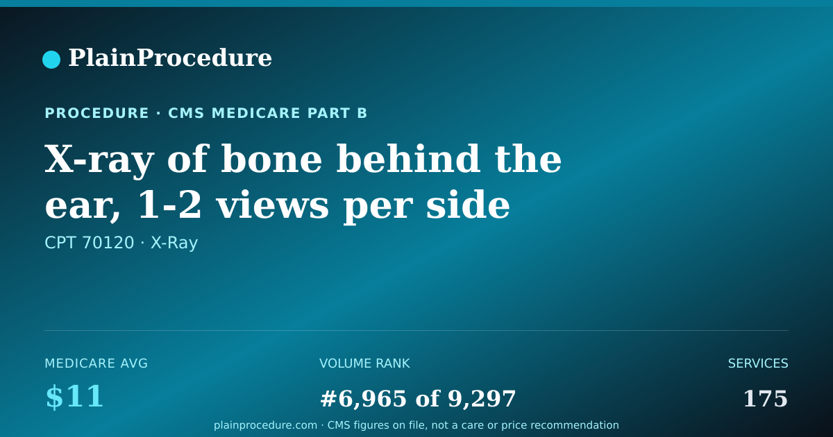 Shareable card for X-Ray Of Bone Behind The Ear, 1-2 Views Per Side