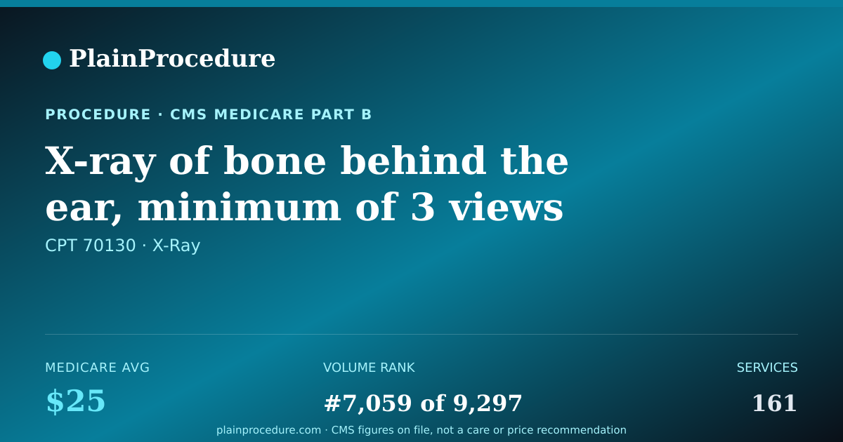 Shareable card for X-Ray Of Bone Behind The Ear, Minimum Of 3 Views Per Side
