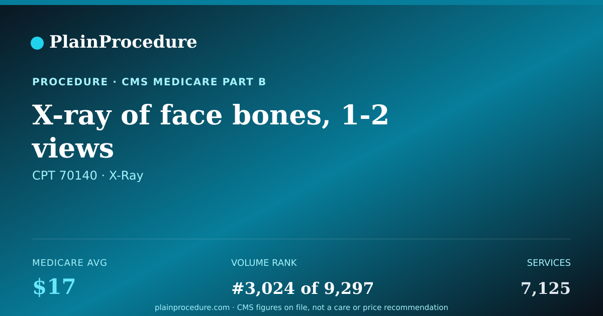 Shareable card for X-Ray Of Face Bones, 1-2 Views