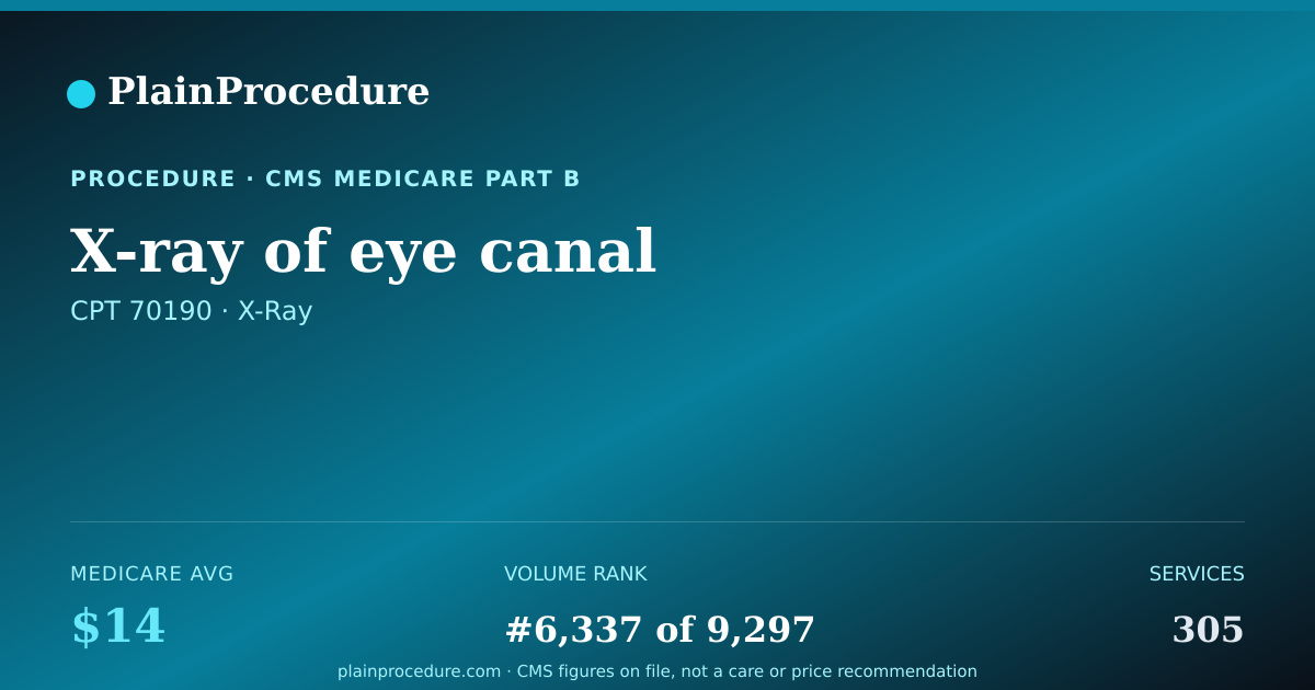 Shareable card for X-Ray Of Eye Canal