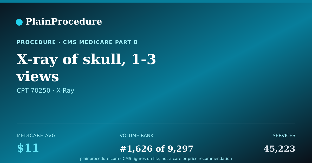 Shareable card for X-Ray Of Skull, 1-3 Views