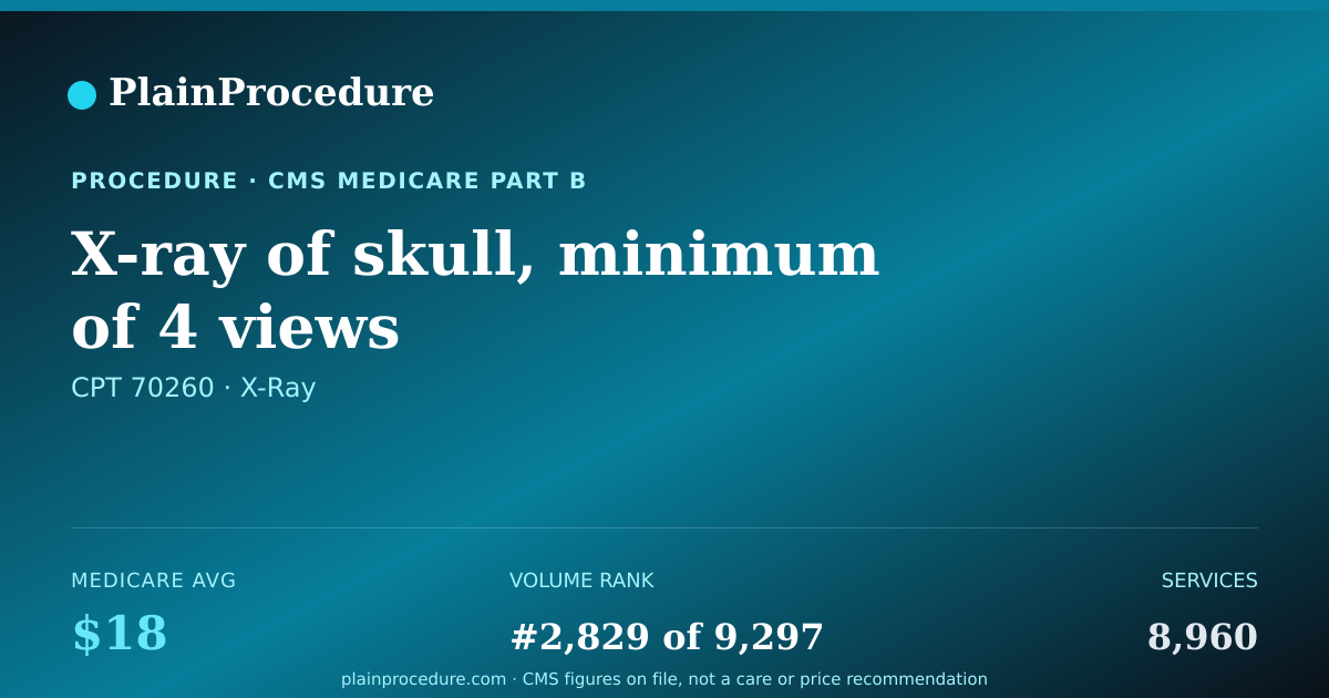 Shareable card for X-Ray Of Skull, Minimum Of 4 Views