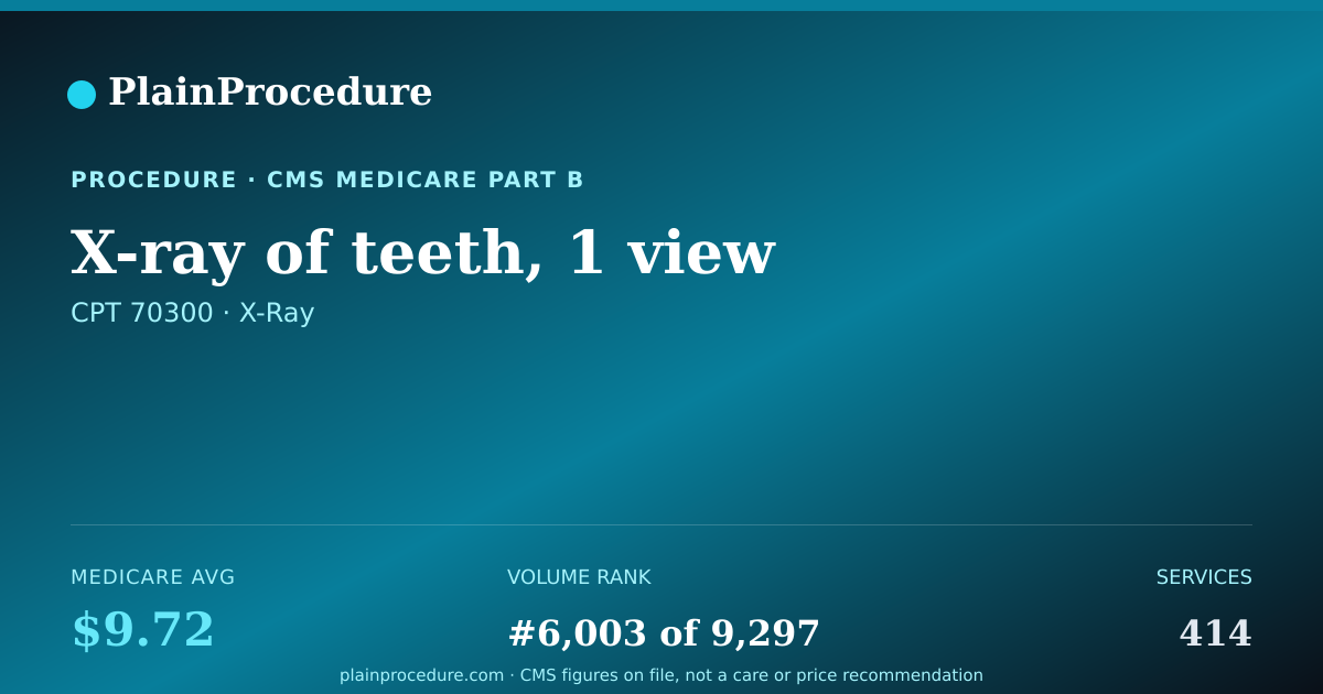 Shareable card for X-Ray Of Teeth, 1 View